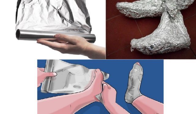 Aluminum removes pain from gout Aluminum removes pain from gout